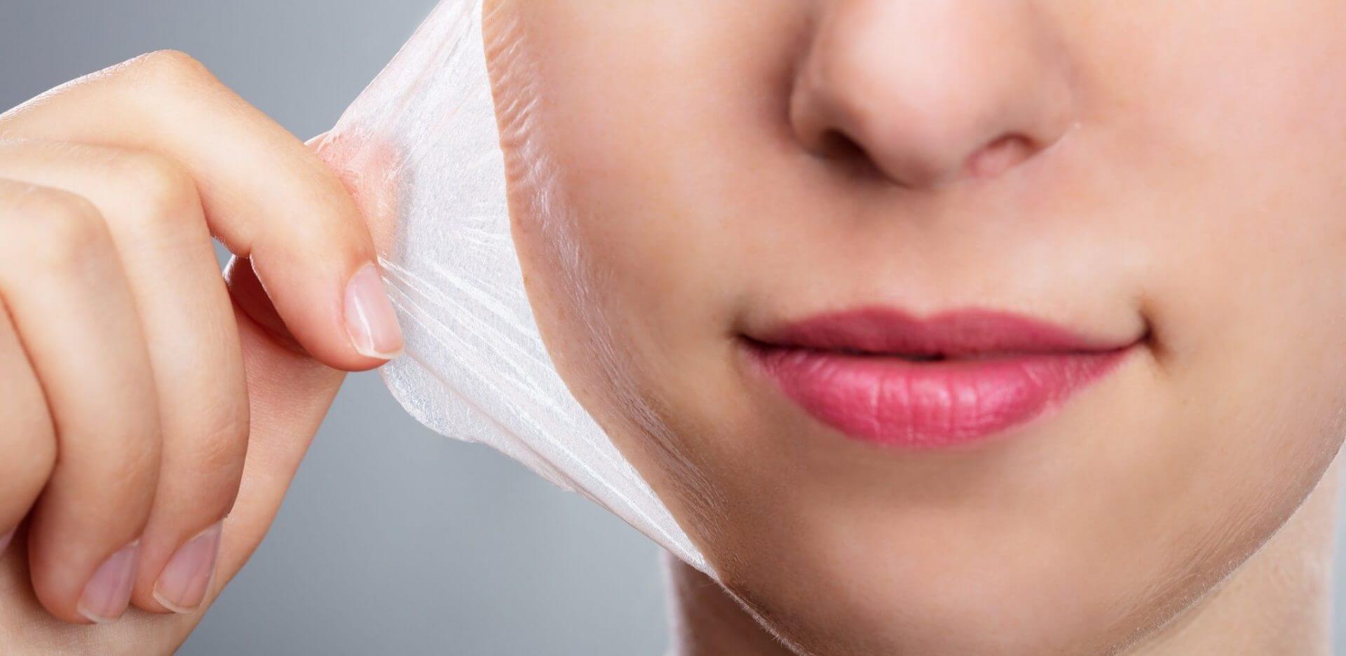 Tratamento de Peeling Dra Marina Dermatologista Tratamento de Peeling Dra Marina Dermatologista